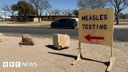 US measles outbreak kills child in Texas