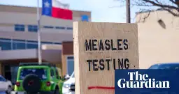 Texas measles outbreak grows to 90 cases, worst level in 30 years