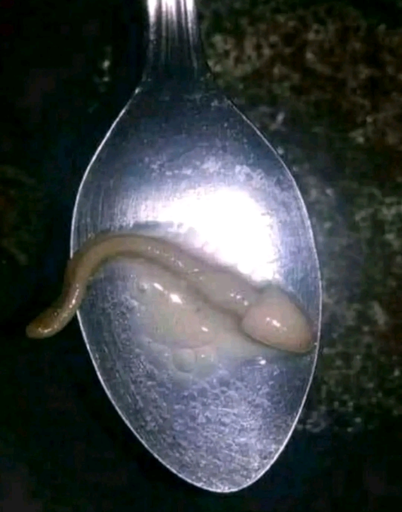 What if men only shot one really big sperm. I bet that would be a scary first experiment for young Billy.Especially if it flopped on the ground like a fish and you had to stomp it to death. Every time
